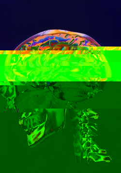 brain.jpg